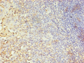 Immunohistochemistry of paraffin-embedded human tonsil tissue using CA5B Antibody at dilution of 1:100