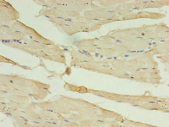 Immunohistochemistry of paraffin-embedded human skeletal muscle tissue using CA5B Antibody at dilution of 1:100