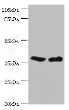 Western blot | All lanes: CA5B antibody at 2μg/ml | Lane 1: Mouse liver tissue | Lane 2: Mouse kidney tissue | Secondary | Goat polyclonal to rabbit IgG at 1/10000 dilution | Predicted band size: 36 kDa | Observed band size: 36 kDa