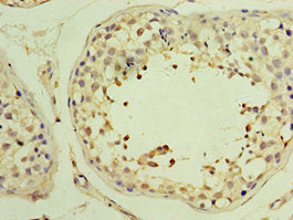 Immunohistochemistry of paraffin-embedded human testis tissue using YARS2 Antibody at dilution of 1:100Rabbit anti-Human YARS2 Polyclonal Antibody