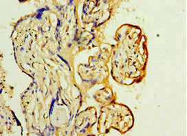 Immunohistochemistry of paraffin-embedded human placenta tissue using YARS2 Antibody at dilution of 1:100Rabbit anti-Human YARS2 Polyclonal Antibody