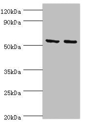 Western blot | All lanes: Tyrosine--tRNA ligase, mitochondrial antibody at 15μg/ml | Lane 1: K562 whole cell lysate | Lane 2: HepG2 whole cell lysate | Secondary | Goat polyclonal to rabbit IgG at 1/10000 dilution | Predicted band size: 53 kDa | Observed band size: 53 kDaRabbit anti-Human YARS2 Polyclonal Antibody