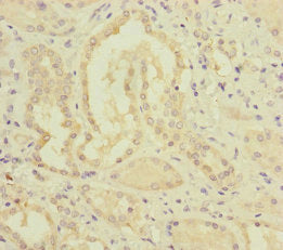 Immunohistochemistry of paraffin-embedded human kidney tissue using MMACHC Antibody at dilution of 1:100Rabbit anti-Human MMACHC Polyclonal Antibody