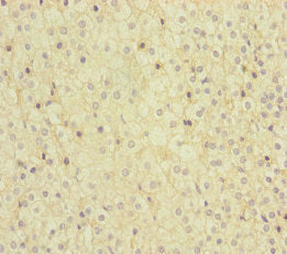 Immunohistochemistry of paraffin-embedded human adrenal gland tissue using MMACHC Antibody at dilution of 1:100Rabbit anti-Human MMACHC Polyclonal Antibody