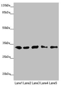Western blot  | All lanes: MMACHC antibody at 5.16µg/ml  | Lane 1: HepG2 whole cell lysate  | Lane 2: K562 whole cell lysate  | Lane 3: A549 whole cell lysate  | Lane 4: Hela whole cell lysate  | Lane 5: Raji whole cell lysate  | Secondary  | Goat polyclonal to rabbit IgG at 1/10000 dilution  | Predicted band size: 32 kDa  | Observed band size: 32 kDa