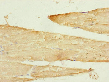 Immunohistochemistry of paraffin-embedded human skeletal muscle tissue using SAMM50 Antibody at dilution of 1:100Rabbit anti-Human SAMM50 Polyclonal Antibody