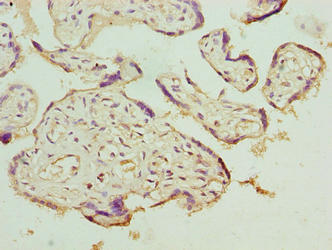 Immunohistochemistry of paraffin-embedded human placenta tissue using LRRC42 Antibody at dilution of 1:100