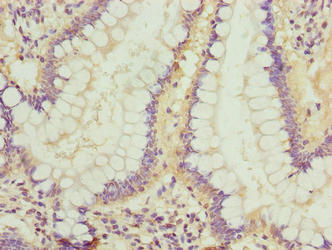 Immunohistochemistry of paraffin-embedded human small intestine tissue using LRRC42 Antibody at dilution of 1:100
