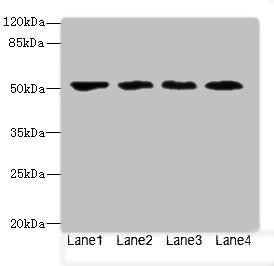 Western blot | All lanes: LRRC42 antibody at 10μg/ml | Lane 1: MCF-7 whole cell lysate | Lane 2: A549 whole cell lysate | Lane 3: HCT116 whole cell lysate | Lane 4: Colo320 whole cell lysate | Secondary | Goat polyclonal to rabbit IgG at 1/10000 dilution | Predicted band size: 49 kDa | Observed band size: 49 kDa