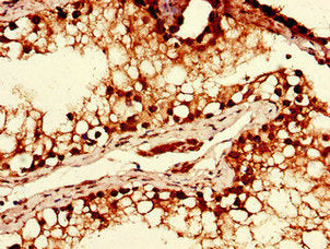 Immunohistochemistry of paraffin-embedded human testis tissue using YTHDF2 Antibody at dilution of 1:100Rabbit anti-Human YTHDF2 Polyclonal Antibody