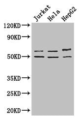 Western Blot | Positive WB detected in: Jurkat whole cell lysate, Hela whole cell lysate, HepG2 whole cell lysate | All lanes: YTHDF2 antibody at 2.7μg/ml | Secondary | Goat polyclonal to rabbit IgG at 1/50000 dilution | Predicted band size: 63, 57 kDa | Observed band size: 63, 50 kDaRabbit anti-Human YTHDF2 Polyclonal Antibody