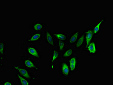 Immunofluorescent analysis of Hela cells using COL4A3BP Antibody at dilution of 1:100 and Alexa Fluor 488-congugated AffiniPure Goat Anti-Rabbit IgG(H+L)Rabbit anti-Human COL4A3BP Polyclonal Antibody