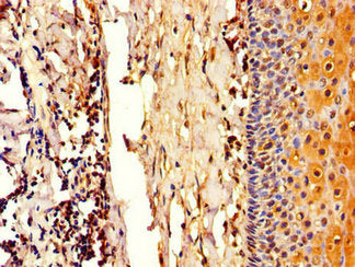 Immunohistochemistry of paraffin-embedded human tonsil tissue using COL4A3BP Antibody at dilution of 1:100Rabbit anti-Human COL4A3BP Polyclonal Antibody