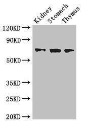 Western Blot | Positive WB detected in: Mouse kidney tissue, Mouse stomach tissue, Mouse thymus tissue | All lanes: COL4A3BP antibody at 3.4μg/ml | Secondary | Goat polyclonal to rabbit IgG at 1/50000 dilution | Predicted band size: 71, 69, 84 kDa | Observed band size: 71 kDaRabbit anti-Human COL4A3BP Polyclonal Antibody