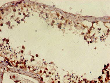 Immunohistochemistry of paraffin-embedded human testis tissue using DMRT1 Antibody at dilution of 1:100Rabbit anti-Human DMRT1 Polyclonal Antibody
