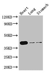 Western Blot | Positive WB detected in: Mouse heart tissue, Mouse lung tissue, Mouse stomach tissue | All lanes: DMRT1 antibody at 3μg/ml | Secondary | Goat polyclonal to rabbit IgG at 1/50000 dilution | Predicted band size: 40, 29, 19 kDa | Observed band size: 40 kDaRabbit anti-Human DMRT1 Polyclonal Antibody