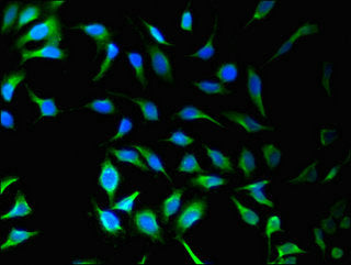Immunofluorescent analysis of Hela cells using SNX9 Antibody at dilution of 1:100 and Alexa Fluor 488-congugated AffiniPure Goat Anti-Rabbit IgG(H+L)Rabbit anti-Human SNX9 Polyclonal Antibody
