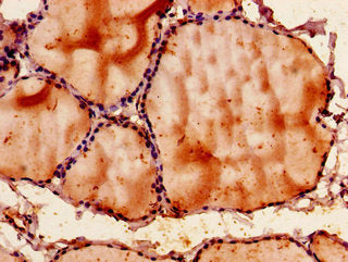 Immunohistochemistry of paraffin-embedded human thyroid tissue using SNX9 Antibody at dilution of 1:100Rabbit anti-Human SNX9 Polyclonal Antibody