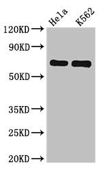Western Blot | Positive WB detected in: Hela whole cell lysate, K562 whole cell lysate | All lanes: SNX9 antibody at 6.2μg/ml | Secondary | Goat polyclonal to rabbit IgG at 1/50000 dilution | Predicted band size: 67 kDa | Observed band size: 67 kDaRabbit anti-Human SNX9 Polyclonal Antibody