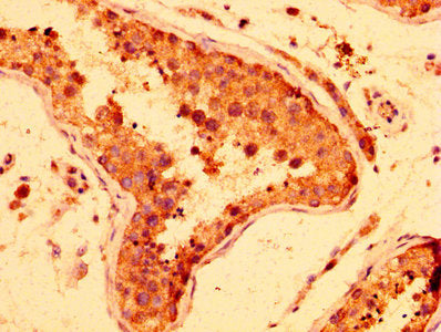 IHC image of LRRFIP2 Antibody diluted at 1:300 and staining in paraffin-embedded human testis tissue performed on a Leica BondTM system. After dewaxing and hydration, antigen retrieval was mediated by high pressure in a citrate buffer (pH 6.0). Section was blocked with 10% normal goat serum 30min at RT. Then primary antibody (1% BSA) was incubated at 4°C overnight. The primary is detected by a biotinylated secondary antibody and visualized using an HRP conjugated SP system.