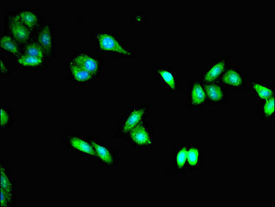 Immunofluorescent analysis of HepG2 cells using TACC3 Antibody at dilution of 1:100 and Alexa Fluor 488-congugated AffiniPure Goat Anti-Rabbit IgG(H+L)Rabbit anti-Human TACC3 Polyclonal Antibody