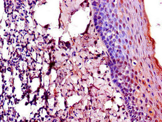Immunohistochemistry of paraffin-embedded human tonsil tissue using the antibody at dilution of 1:100Rabbit anti-Human TACC3 Polyclonal Antibody