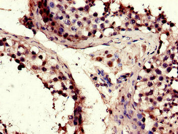 Immunohistochemistry of paraffin-embedded human testis tissue using TACC3 Antibody at dilution of 1:100Rabbit anti-Human TACC3 Polyclonal Antibody
