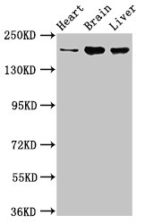 Western Blot | Positive WB detected in: Rat heart tissue, Mouse brain tissue, Mouse liver tissue | All lanes: ARFGEF2 antibody at 3.2μg/ml | Secondary | Goat polyclonal to rabbit IgG at 1/50000 dilution | Predicted band size: 203 kDa | Observed band size: 203 kDaRabbit anti-Human ARFGEF2 Polyclonal Antibody