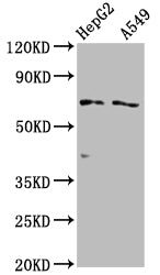 Western Blot | Positive WB detected in: HepG2 whole cell lysate, A549 whole cell lysate | All lanes: SLCO1B1 antibody at 1:2000 | Secondary | Goat polyclonal to rabbit IgG at 1/50000 dilution | Predicted band size: 77 kDa | Observed band size: 77 kDaRabbit anti-Human SLCO1B1 Polyclonal Antibody