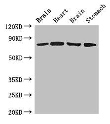 Western Blot | Positive WB detected in: Rat brain tissue, Rat heart tissue, Mouse brain tissue, Mouse stomach tissue | All lanes: SLCO1B1 antibody at 4μg/ml | Secondary | Goat polyclonal to rabbit IgG at 1/50000 dilution | Predicted band size: 77 kDa | Observed band size: 77 kDaRabbit anti-Human SLCO1B1 Polyclonal Antibody