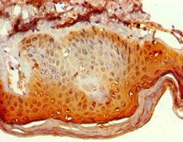 Immunohistochemistry of paraffin-embedded human skin tissue using POLR1D Antibody at dilution of 1:100