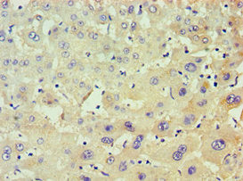 Immunohistochemistry of paraffin-embedded human liver tissue using POLR1D Antibody at dilution of 1:100