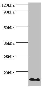 Western blot | All lanes: DNA-directed RNA polymerases I and III subunit RPAC2 antibody at 10μg/ml + Jurkat whole cell lysate | Secondary | Goat polyclonal to rabbit IgG at 1/10000 dilution | Predicted band size: 16, 15 kDa | Observed band size: 16 kDa