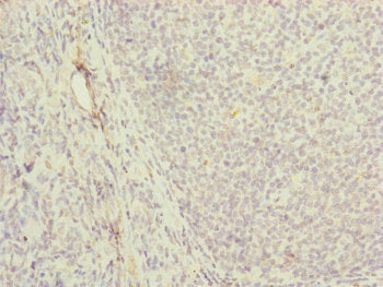 Immunohistochemistry of paraffin-embedded human tonsil tissue using MRPS16 Antibody at dilution of 1:100Rabbit anti-Human MRPS16 Polyclonal Antibody