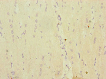 Immunohistochemistry of paraffin-embedded human heart tissue using MRPS16 Antibody at dilution of 1:100Rabbit anti-Human MRPS16 Polyclonal Antibody