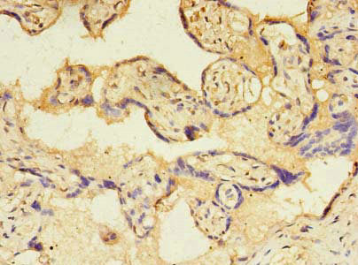 Immunohistochemistry of paraffin-embedded human placenta tissue using TMED3 Antibody at dilution of 1:100Rabbit anti-Human TMED3 Polyclonal Antibody