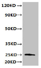 Western blot | All lanes: TMED3 antibody at 6μg/ml + MCF-7 whole cell lysate | Secondary | Goat polyclonal to rabbit IgG at 1/10000 dilution | Predicted band size: 25, 20 kDa | Observed band size: 25 kDaRabbit anti-Human TMED3 Polyclonal Antibody