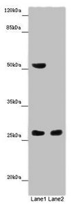 Western blot | All lanes: CHTOP antibody at 14 μg/ml | Lane 1: Mouse heart tissue | Lane 2: Mouse kidney tissue | Secondary | Goat polyclonal to rabbit IgG at 1/10000 dilution | Predicted band size: 27, 22 kDa | Observed band size: 27, 52 kDaRabbit anti-Human CHTOP Polyclonal Antibody