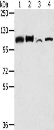 Gel: 6%SDS-PAGE,Lysate: 40 μg,Lane 1-4: Hela cells, HepG2 cells, NIH/3T3 cells, A431 cells,Primary antibody: LONP1 Antibody(LONP1 Antibody) at dilution 1/250 dilution,Secondary antibody: Goat anti rabbit IgG at 1/8000 dilution,Exposure time: 30 seconds