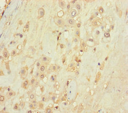 Immunohistochemistry of paraffin-embedded human placenta tissue using TLN2 Antibody at dilution of 1:100