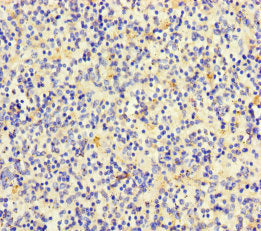 Immunohistochemistry of paraffin-embedded human spleen tissue using TLN2 Antibody at dilution of 1:100