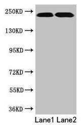 Western blot  | All lanes: TLN2 antibody at 12μg/ml  | Lane 1: Hela whole cell lysate  | Lane 2: Jurkat whole cell lysate  | Secondary  | Goat polyclonal to rabbit IgG at 1/10000 dilution  | Predicted band size: 272 kDa  | Observed band size: 230 kDa