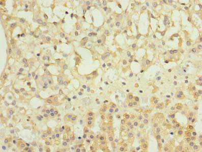 Immunohistochemistry of paraffin-embedded human adrenal gland tissue using NME7 Antibody at dilution of 1:100Rabbit anti-Human NME7 Polyclonal Antibody