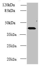 Western blot | All lanes: NME7 antibody at 12μg/ml + Mouse liver tissue | Secondary | Goat polyclonal to rabbit IgG at 1/10000 dilution | Predicted band size: 43, 39 kDa | Observed band size: 43 kDaRabbit anti-Human NME7 Polyclonal Antibody