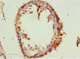 Immunohistochemistry of paraffin-embedded human testis tissue using SPIN1 Antibody at dilution of 1:100Rabbit anti-Human SPIN1 Polyclonal Antibody