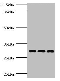 Western blot  | All lanes: SPIN1 antibody at 1.45µg/ml  | Lane 1: Hela whole cell lysate  | Lane 2: 293T whole cell lysate  | Lane 3: HepG2 whole cell lysate  | Secondary  | Goat polyclonal to rabbit IgG at 1/10000 dilution  | Predicted band size: 30 kDa  | Observed band size: 30 kDaRabbit anti-Human SPIN1 Polyclonal Antibody