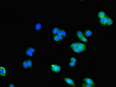 Immunofluorescent analysis of HepG2 cells using AK5 Antibody at dilution of 1:100 and Alexa Fluor 488-congugated AffiniPure Goat Anti-Rabbit IgG(H+L)Rabbit anti-Human AK5 Polyclonal Antibody
