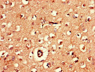 Immunohistochemistry of paraffin-embedded human brain tissue using AK5 Antibody at dilution of 1:100Rabbit anti-Human AK5 Polyclonal Antibody