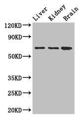 Western Blot | Positive WB detected in: Mouse liver tissue, Mouse kidney tissue, Mouse brain tissue | All lanes: AK5 antibody at 2.5μg/ml | Secondary | Goat polyclonal to rabbit IgG at 1/50000 dilution | Predicted band size: 64, 22, 61 kDa | Observed band size: 64 kDaRabbit anti-Human AK5 Polyclonal Antibody