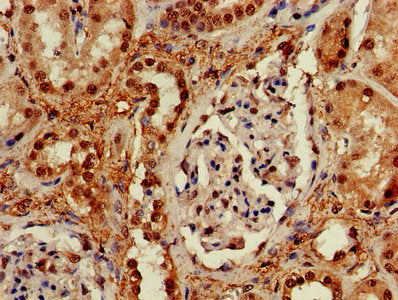 IHC image of RUVBL2 Antibody diluted at 1:600 and staining in paraffin-embedded human kidney tissue performed on a Leica BondTM system. After dewaxing and hydration, antigen retrieval was mediated by high pressure in a citrate buffer (pH 6.0). Section was blocked with 10% normal goat serum 30min at RT. Then primary antibody (1% BSA) was incubated at 4°C overnight. The primary is detected by a biotinylated secondary antibody and visualized using an HRP conjugated SP system.Rabbit anti-Human RUVBL2 Polyclonal Antibody